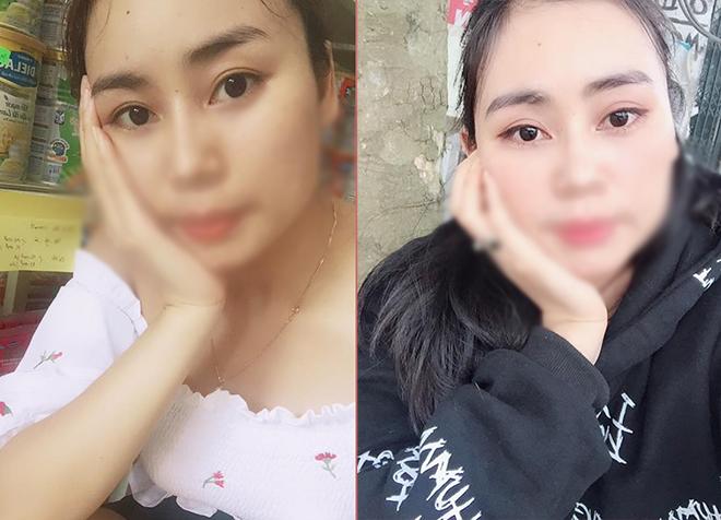 nang chan may cai thien nep nhan va mi sup nhung khong chi danh cho phu nu trung nien! - 9