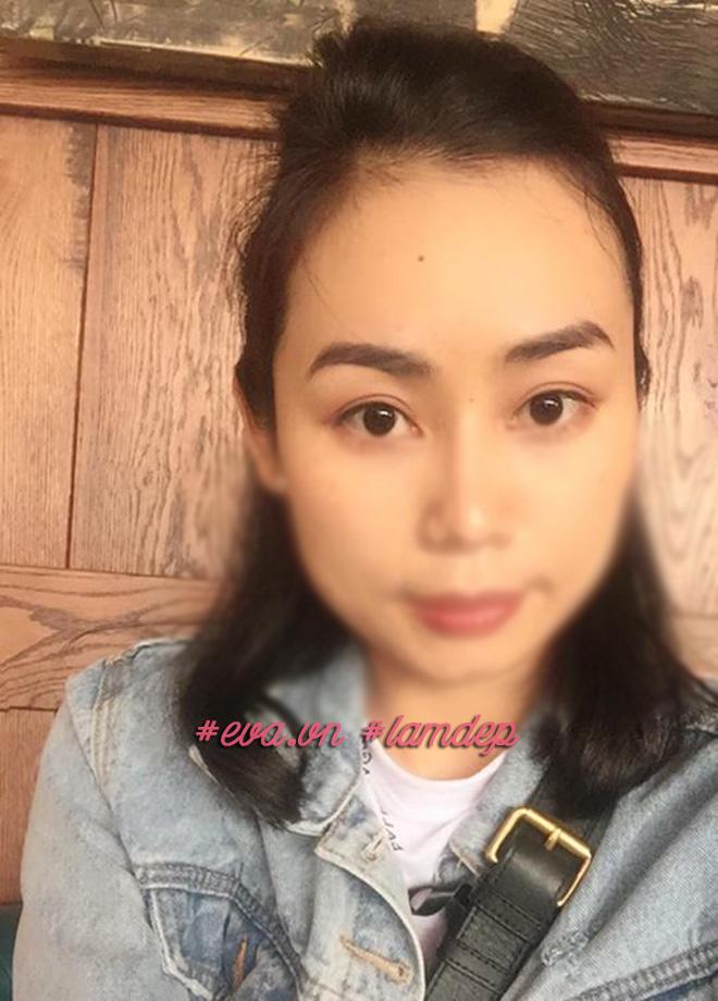 nang chan may cai thien nep nhan va mi sup nhung khong chi danh cho phu nu trung nien! - 6