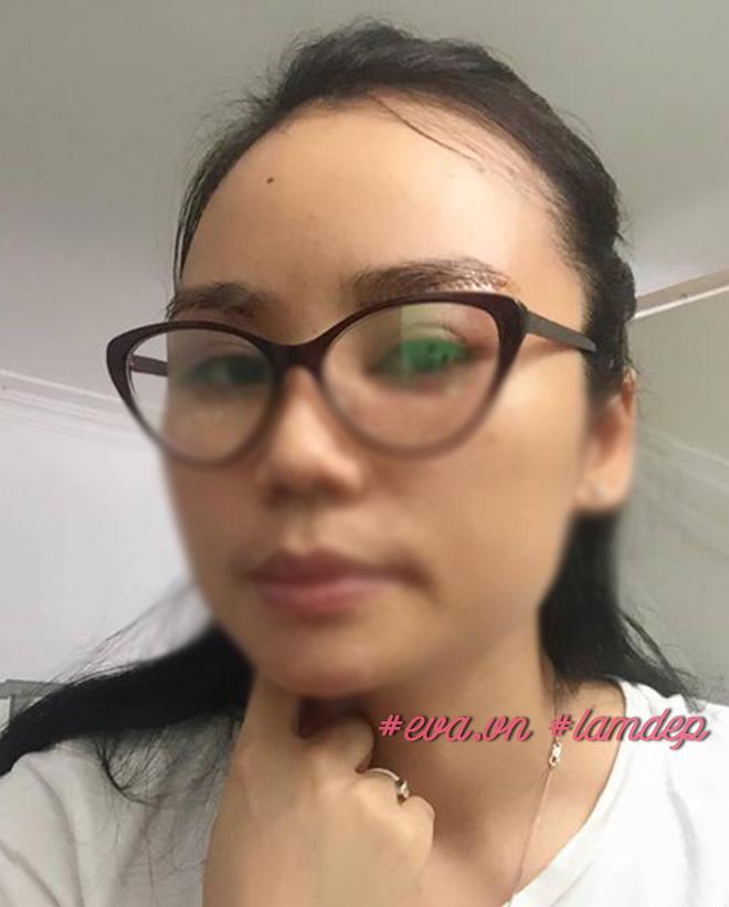 nang chan may cai thien nep nhan va mi sup nhung khong chi danh cho phu nu trung nien! - 7