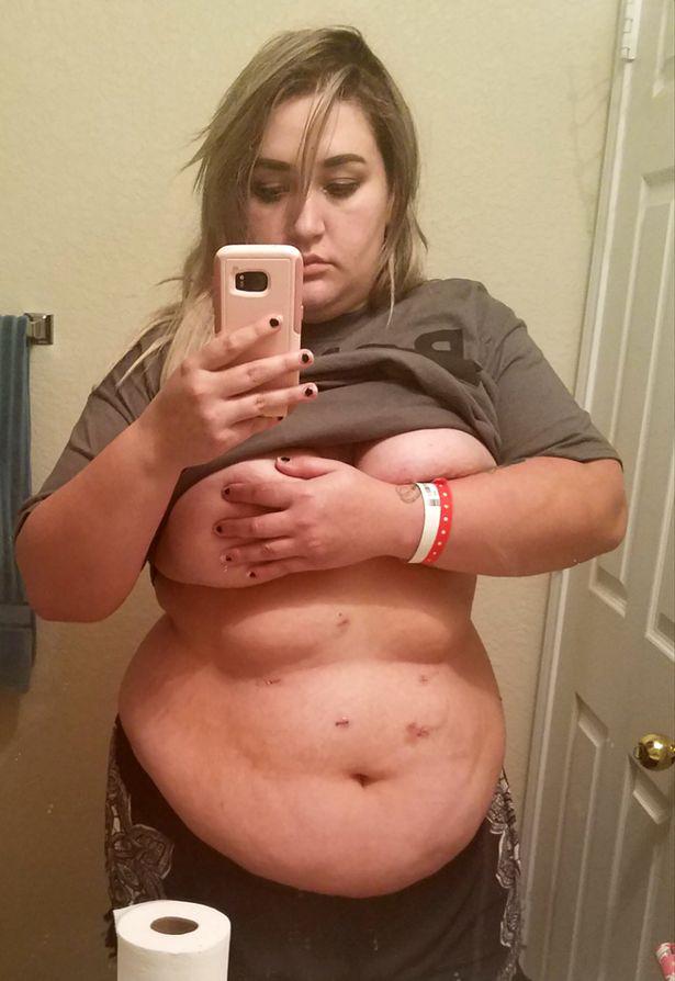 say thai 6 lan vi qua beo, co gai lot xac ngoan muc de sinh con va lam nguoi mau - 1