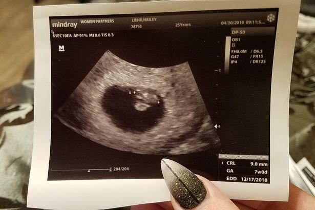 say thai 6 lan vi qua beo, co gai lot xac ngoan muc de sinh con va lam nguoi mau - 4