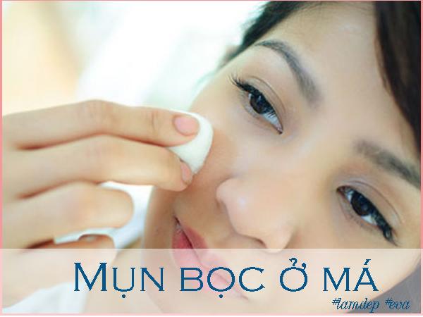 ngay nao cung lam theo, mun boc o ma nang co nao cung bi xoa mo cuc nhanh - 9