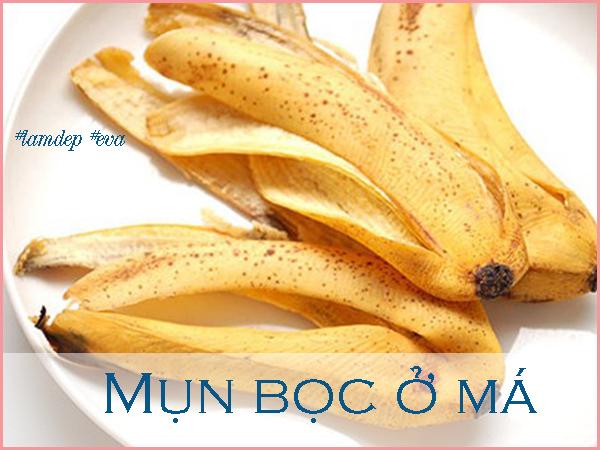 ngay nao cung lam theo, mun boc o ma nang co nao cung bi xoa mo cuc nhanh - 2