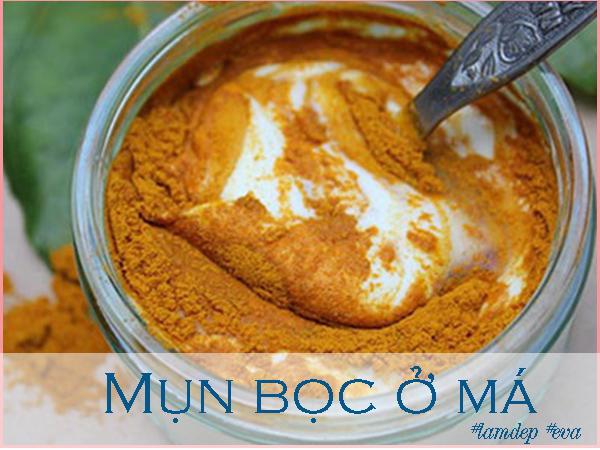 ngay nao cung lam theo, mun boc o ma nang co nao cung bi xoa mo cuc nhanh - 5