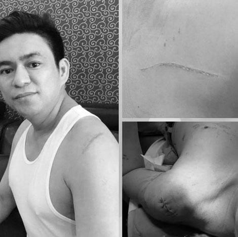 phia sau ban hop dong thue giang ho truy sat bac si chiem quoc thai - 2