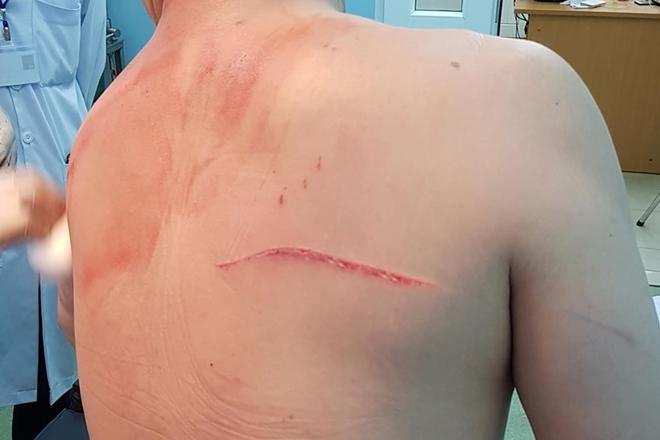 vo bac si chiem quoc thai khai gi ve hop dong tien ty thue giang ho chem chong? - 3