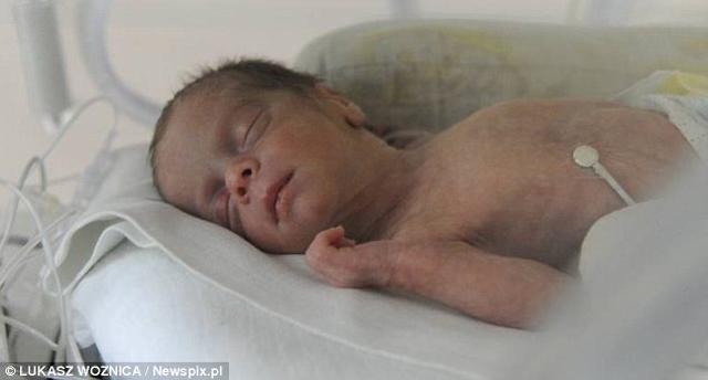 dau de tan 75 ngay, nguoi me phai nam "chong nguoc" hon 2 thang de giu tinh mang cho con - 3