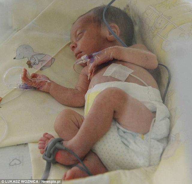 dau de tan 75 ngay, nguoi me phai nam "chong nguoc" hon 2 thang de giu tinh mang cho con - 4