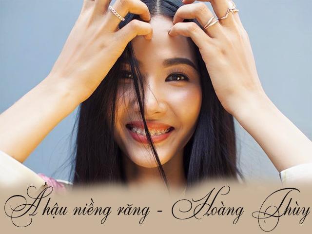 Hoàng Thùy khoe mình là Á hậu đầu tiên đeo niềng răng, chuẩn bị đến với Miss Universe 2019?