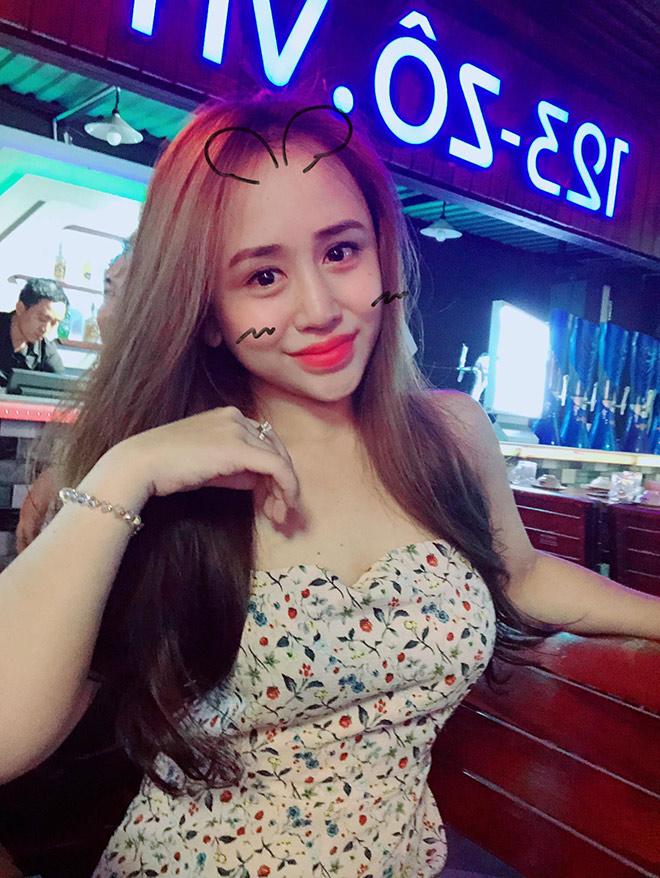 tiem tan mo: khong chay mau, khong phau thuat, hieu qua tinh bang thang, chi em da cap nhat chua? - 10