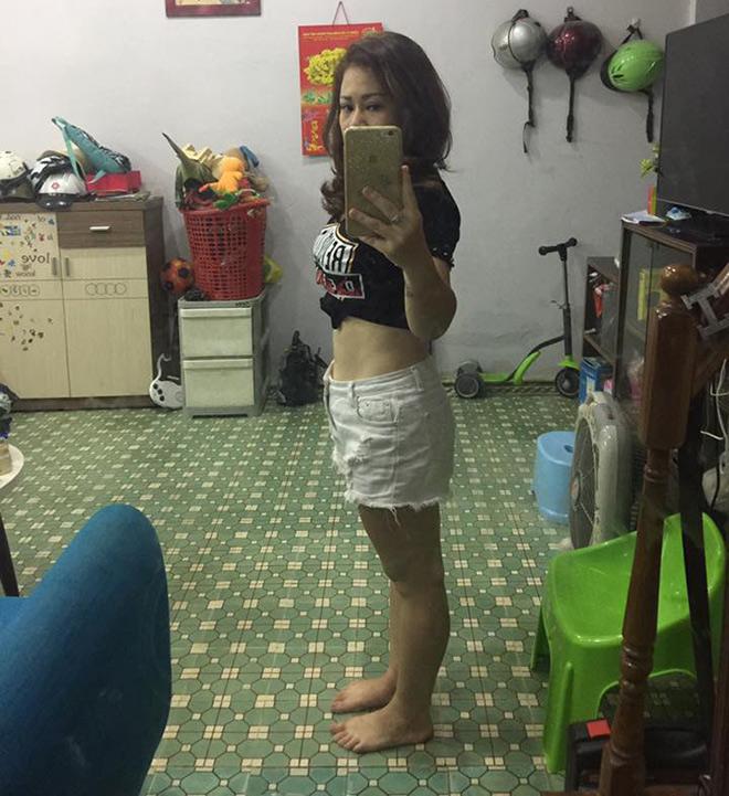 tiem tan mo: khong chay mau, khong phau thuat, hieu qua tinh bang thang, chi em da cap nhat chua? - 3