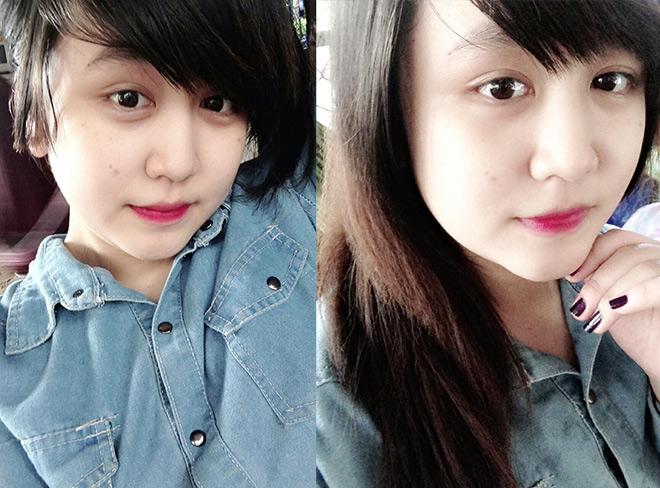 tiem tan mo: khong chay mau, khong phau thuat, hieu qua tinh bang thang, chi em da cap nhat chua? - 5