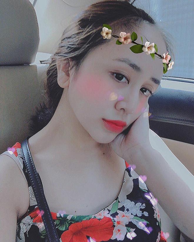 tiem tan mo: khong chay mau, khong phau thuat, hieu qua tinh bang thang, chi em da cap nhat chua? - 9