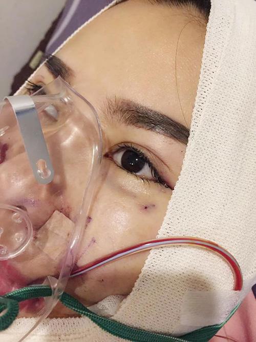 que van tiet lo chi vai tram trieu lam dep, cong khai sang han phau thuat lan thu 6 - 6