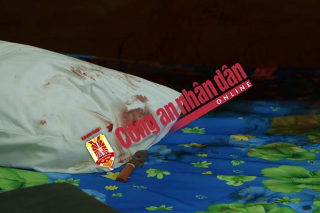 co gai gao thet ben ban trai be bet mau trong phong khach san - 2