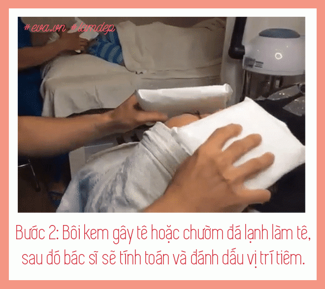 nong cam, mo bap tay, mo bung tan bien sau vai phut nho tiem tan mo, thuc hu ra sao? - 6