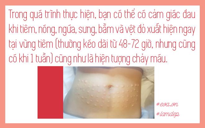 nong cam, mo bap tay, mo bung tan bien sau vai phut nho tiem tan mo, thuc hu ra sao? - 10
