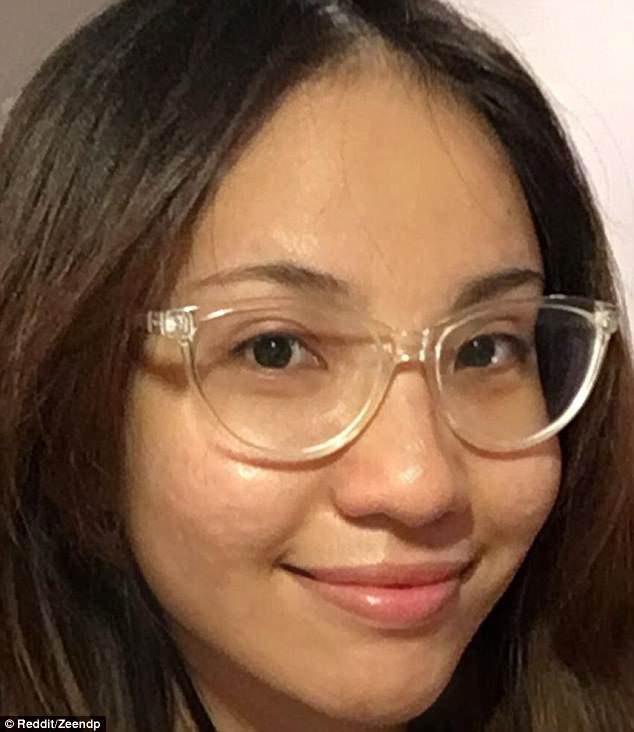 hanh trinh tri mun kien tri 11 nam cua co gai goc viet gay chan dong bao nuoc ngoai - 2