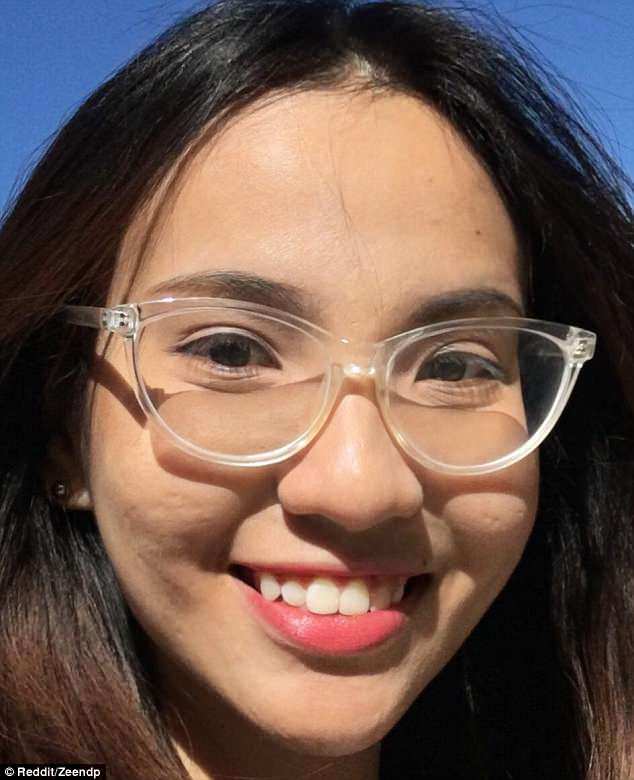 hanh trinh tri mun kien tri 11 nam cua co gai goc viet gay chan dong bao nuoc ngoai - 5