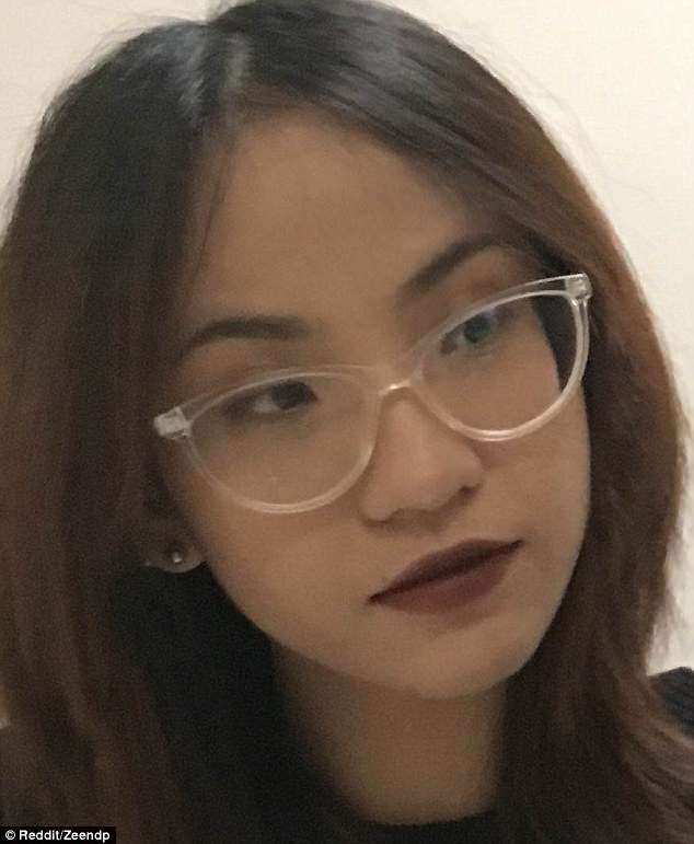 hanh trinh tri mun kien tri 11 nam cua co gai goc viet gay chan dong bao nuoc ngoai - 6