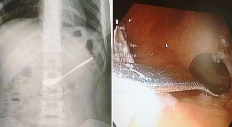 tin tuc 24h: rung dong vu tham sat 9 nguoi trong gia dinh vao dung ngay cuoi cua co dau - 2