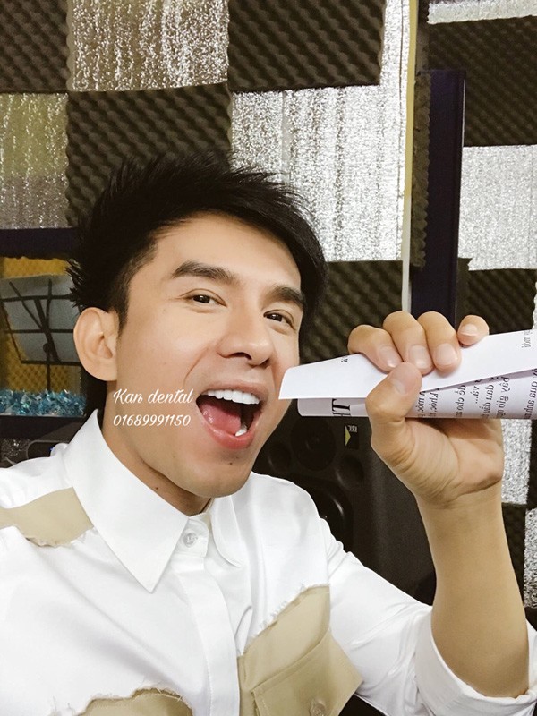 dan truong bat ngo khoe ham rang trang sang ben canh chang nha si dien trai - 1