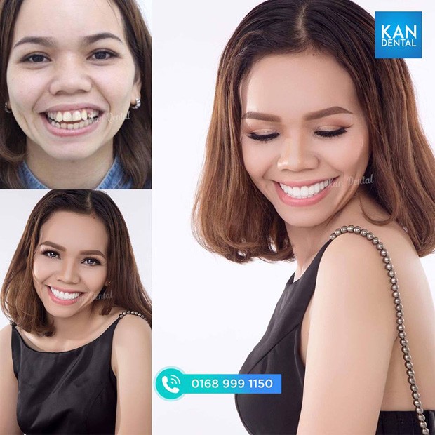 dan truong bat ngo khoe ham rang trang sang ben canh chang nha si dien trai - 5