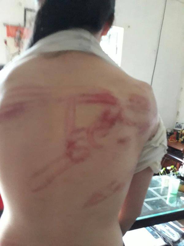 tin tuc 24h: tiet lo loi khai cua ga trai be bet mau guc ben ban gai trong khach san - 2