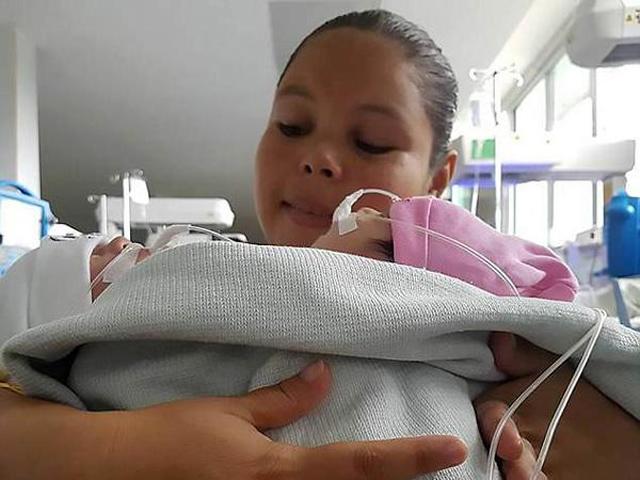 Chưa kịp vui mừng vì sinh đôi, mẹ chết lặng khi nhìn hai con lúc chào đời