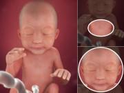 Thai nhi 24 tuần tuổi: Tử cung mẹ to bằng một quả bóng