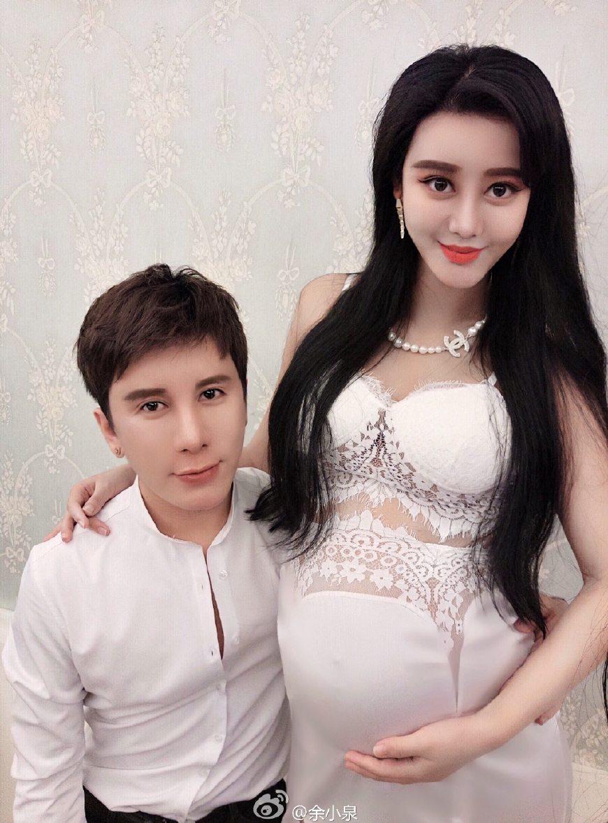 chi em xu trung dua nhau phau thuat mat lai tay de "song ao" - 3