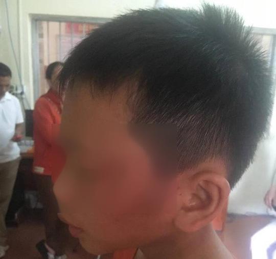 nghi van nu giao vien bao hanh con rieng cua chong nhap vien - 1