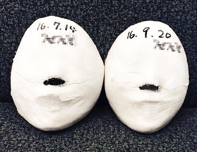 Trải nghiệm liệu pháp Golki điều chỉnh khuôn mặt cực hot tại Yakson Beauty Spa - 6