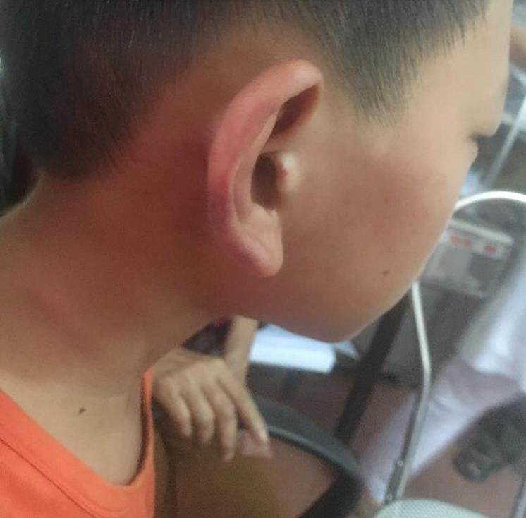 lo ly do me ke bao hanh con rieng cua chong phai nhap vien o nghe an - 1