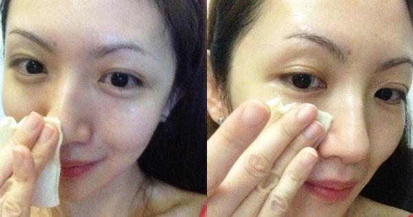 dung lo de xong se xau vi da co 3 cach cham soc da mat sau sinh cho cac chi - 2