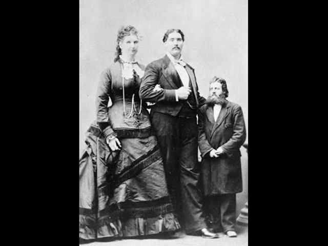 nguoi phu nu so huu "co be" rong toi hon 48 cm, van lay chong va sinh con binh thuong - 2