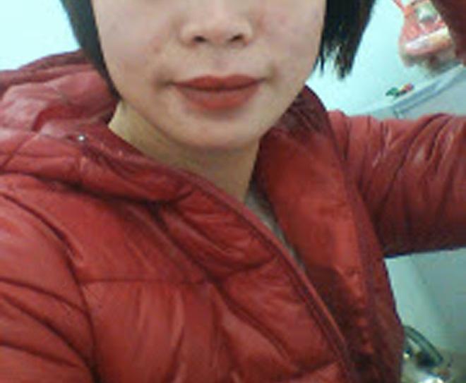 cung di phun moi: nguoi thi lanh nhanh mau len dep, nguoi lai kho so dau don mat tien oan! - 5