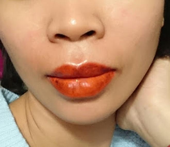 cung di phun moi: nguoi thi lanh nhanh mau len dep, nguoi lai kho so dau don mat tien oan! - 7