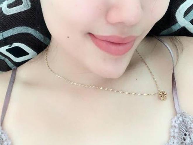 cung di phun moi: nguoi thi lanh nhanh mau len dep, nguoi lai kho so dau don mat tien oan! - 4