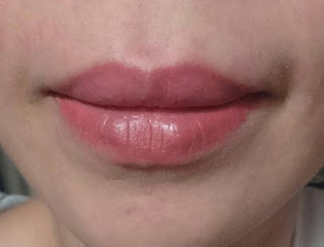 cung di phun moi: nguoi thi lanh nhanh mau len dep, nguoi lai kho so dau don mat tien oan! - 9