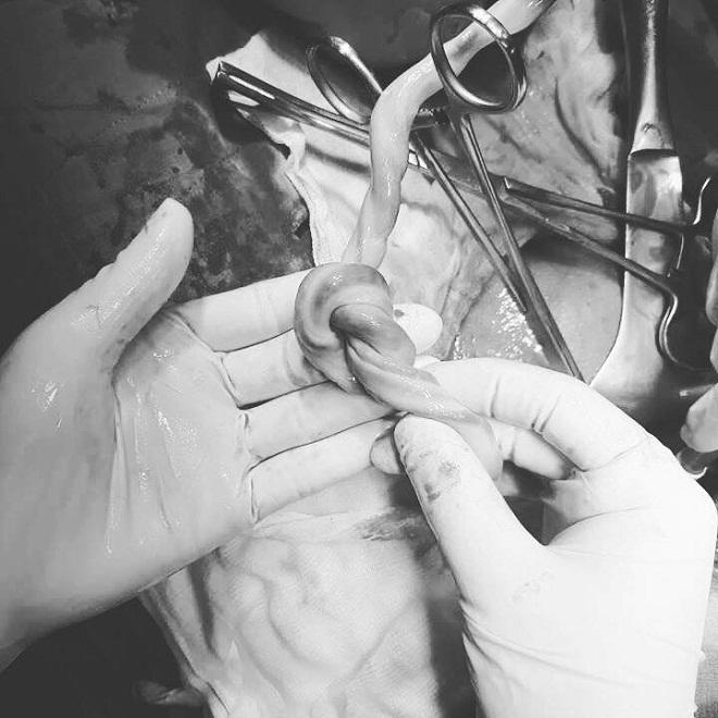 tin tuc 24h: than nhien "may mua" o cua so, cap doi gay bat ngo vao phut cuoi - 3