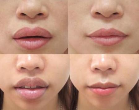 chu spa hanh phuc khoe thanh qua moi "trai tim" nhung khien dan mang day song vi diem nay! - 3