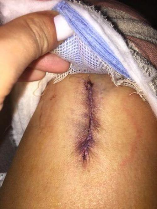 chi vi luoi boi kem chong nang, co nang nay suyt nua phai tra gia bang tinh mang cua minh - 3