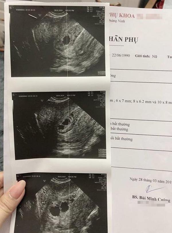 Bác sĩ có phản ứng bất ngờ trước hình ảnh siêu âm Thai lần 2, điều này tỏ ra rằng thai nhi của bạn đang phát triển vượt trội. Hãy xem hình ảnh này để thấy rõ sự thay đổi của thai nhi và được hướng dẫn cách chăm sóc thai kỳ một cách tốt nhất.