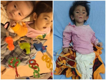 Mẹ nuôi ghi hình trực tiếp tiết lộ tình trạng hiện tại của bé gái Lào Cai