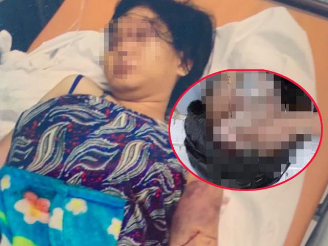 Tin tức 24h: Nhân chứng vụ cô gái bị tra tấn sảy thai hoảng hốt khi mở túi nilon đen