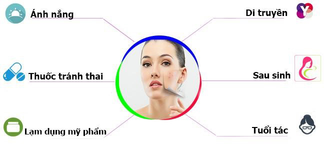 Melasma - giải pháp chăm sóc da toàn diện cho phái đẹp