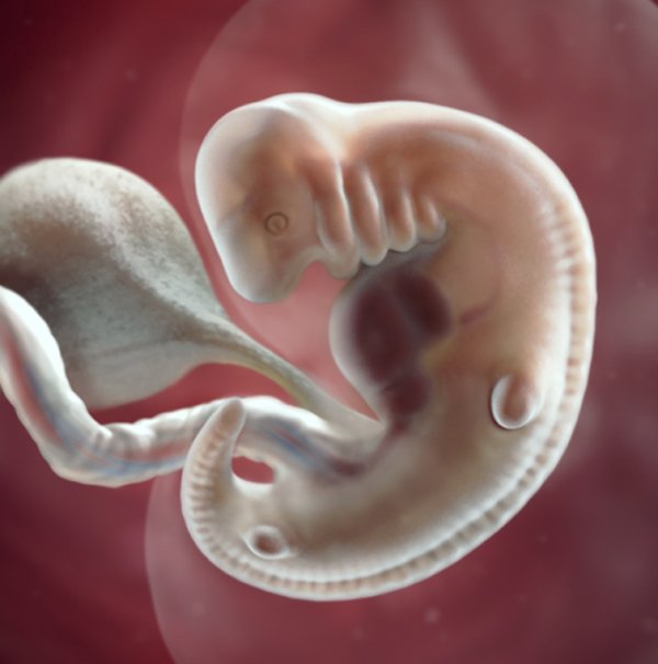 Dấu hiệu thai chết lưu 8 tuần, nguyên nhân và cách xử lý an toàn nhất - 4