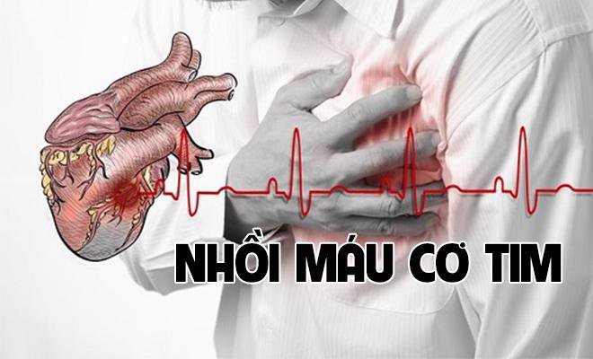 nhoi mau co tim: nguyen nhan, dau hieu va bien chung - 1