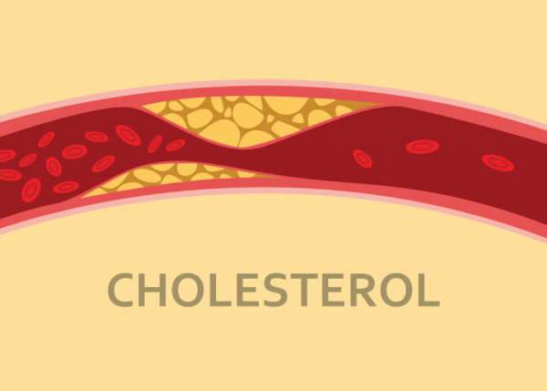 thuc pham nao nhieu cholesterol va cach giam cholesterol hieu qua - 1